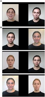 Intersensory redundancy impedes face recognition in 12-month-old infants